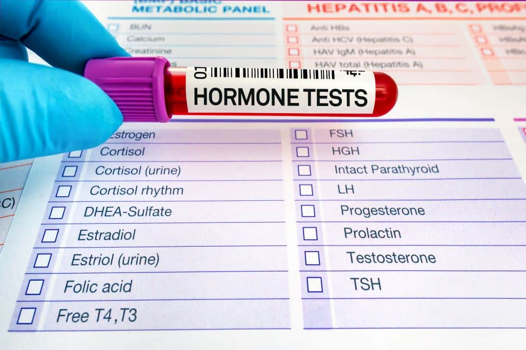 Why Lab Testing Is Crucial Before You Start Bioidentical Hormone Replacement Therapy (BHRT)